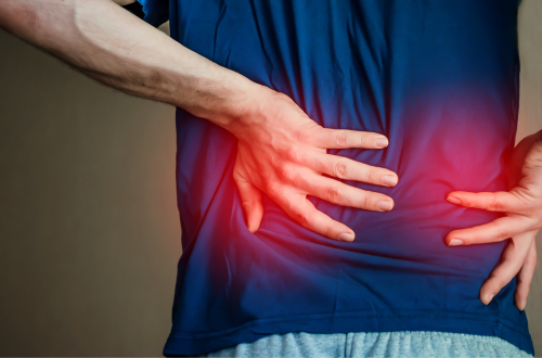 back pain condition to be treated by physiotherapist