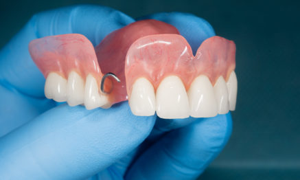 Dentures restorative dental treatment
