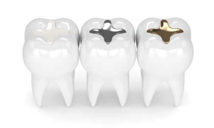 Dental various types of filling from Amalgam to Composite