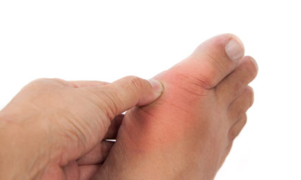 Gout can be treated by our Podiatrsit