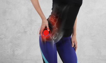 Hip pain can be treated by Physiotherapist
