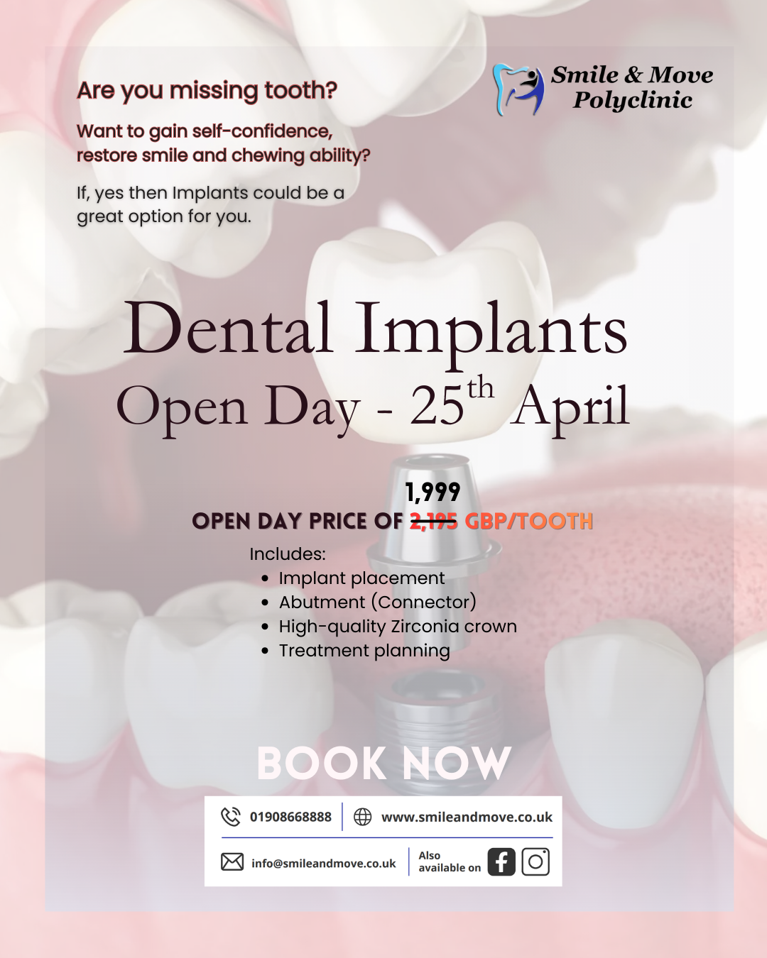 Flyer for Dental Implants Open Day on 25th April at Smile and Move Polyclinic