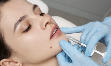 Dermal Filler service at Smile and Move Polyclinic